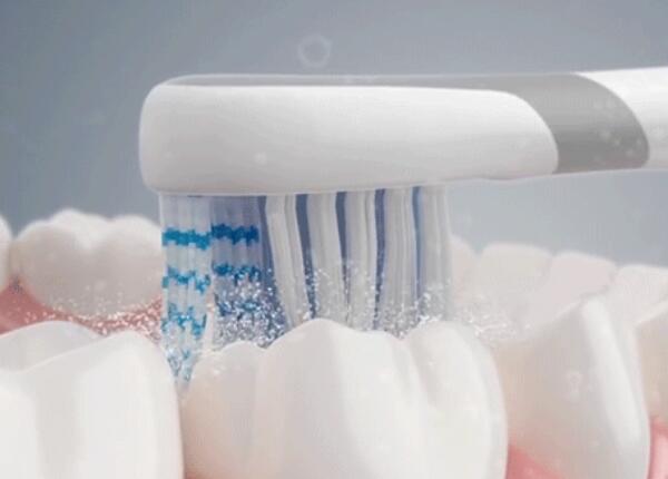 電動牙刷刷牙好嗎？真的比手動牙刷更好嗎？